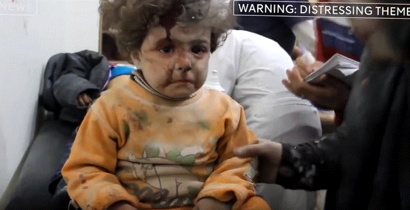 مقطع مؤثر.. طفلة مصابة في حلب تكتم بكائها