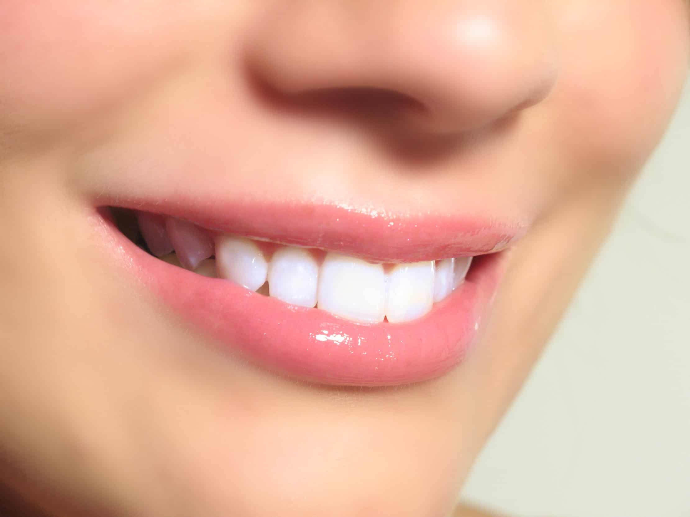 طرق طبيعية ووصفات منزلية لعلاج تكلسات الأسنان .. هل جربتوها من قبل؟