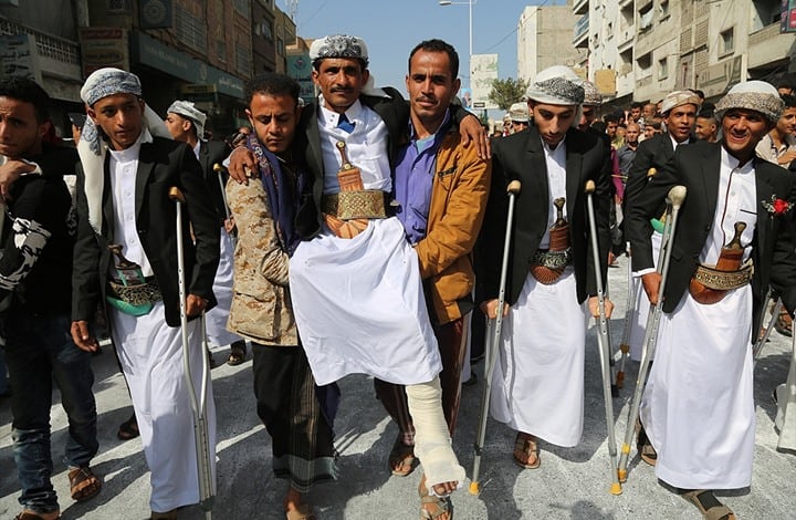 بالصور.. اليمن تزف 40 عريسا بترت أطرافهم خلال الحرب
