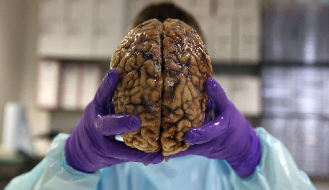 العثور على أقدم دماغ بشري