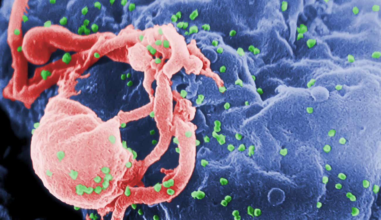 تطوير تقنية تمنع الإيدز من استهداف الخلايا