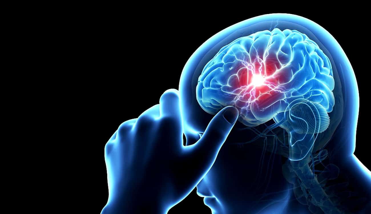 4 إشارات تدل على تعرض للإصابة بـ «السكتة الدماغية»