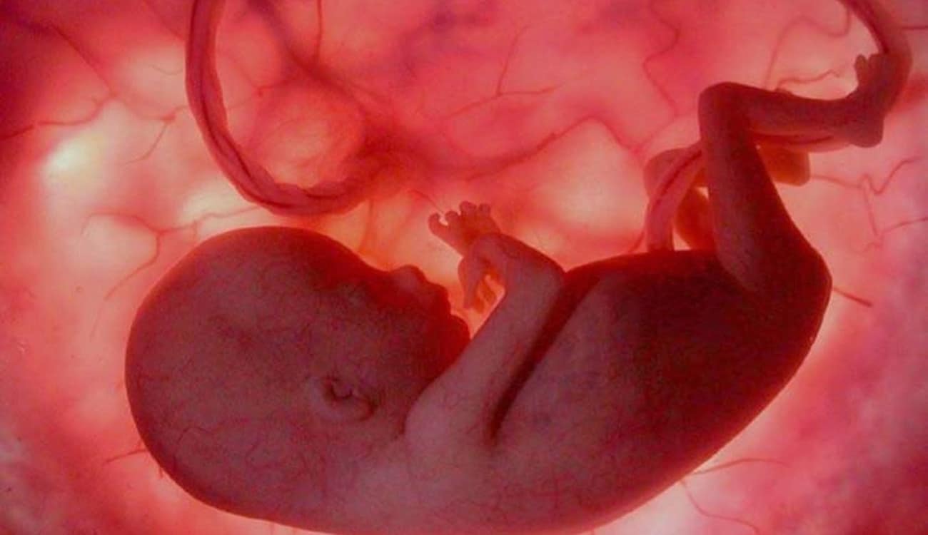 بالصور.. حالة غريبة لطفلة تولد بجنين يتدلى من بطنها