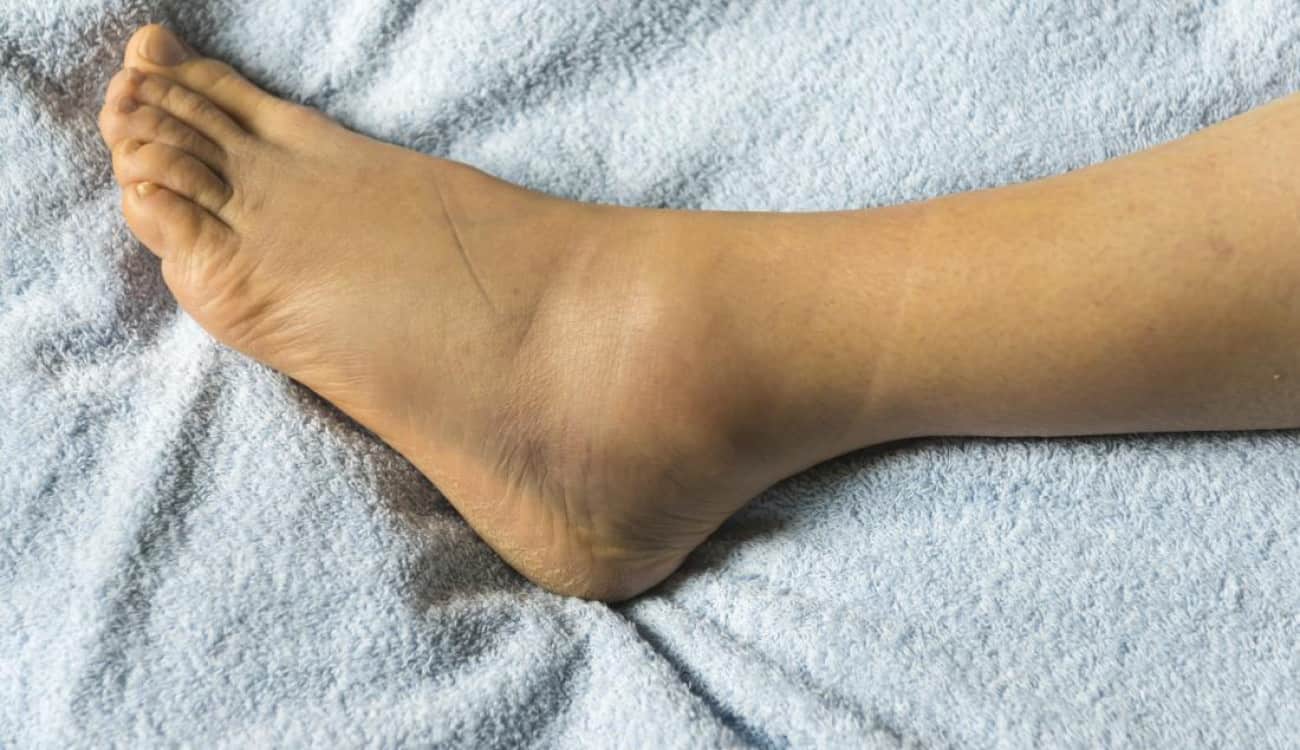 أطباء يحذّرون: تورم القدمين مؤشر للإصابة بهذه الأمراض الخطيرة!
