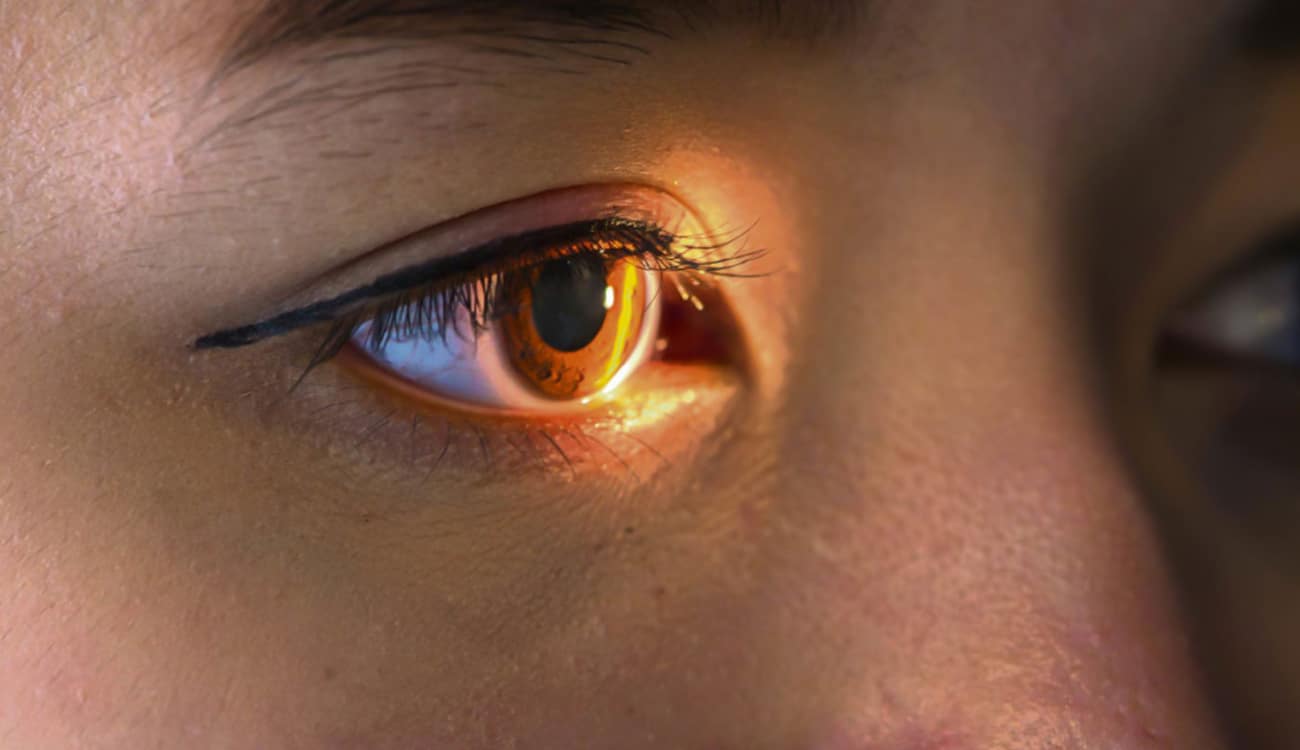 باحثون يطورون شبكية مخلقة تقضي على العمى