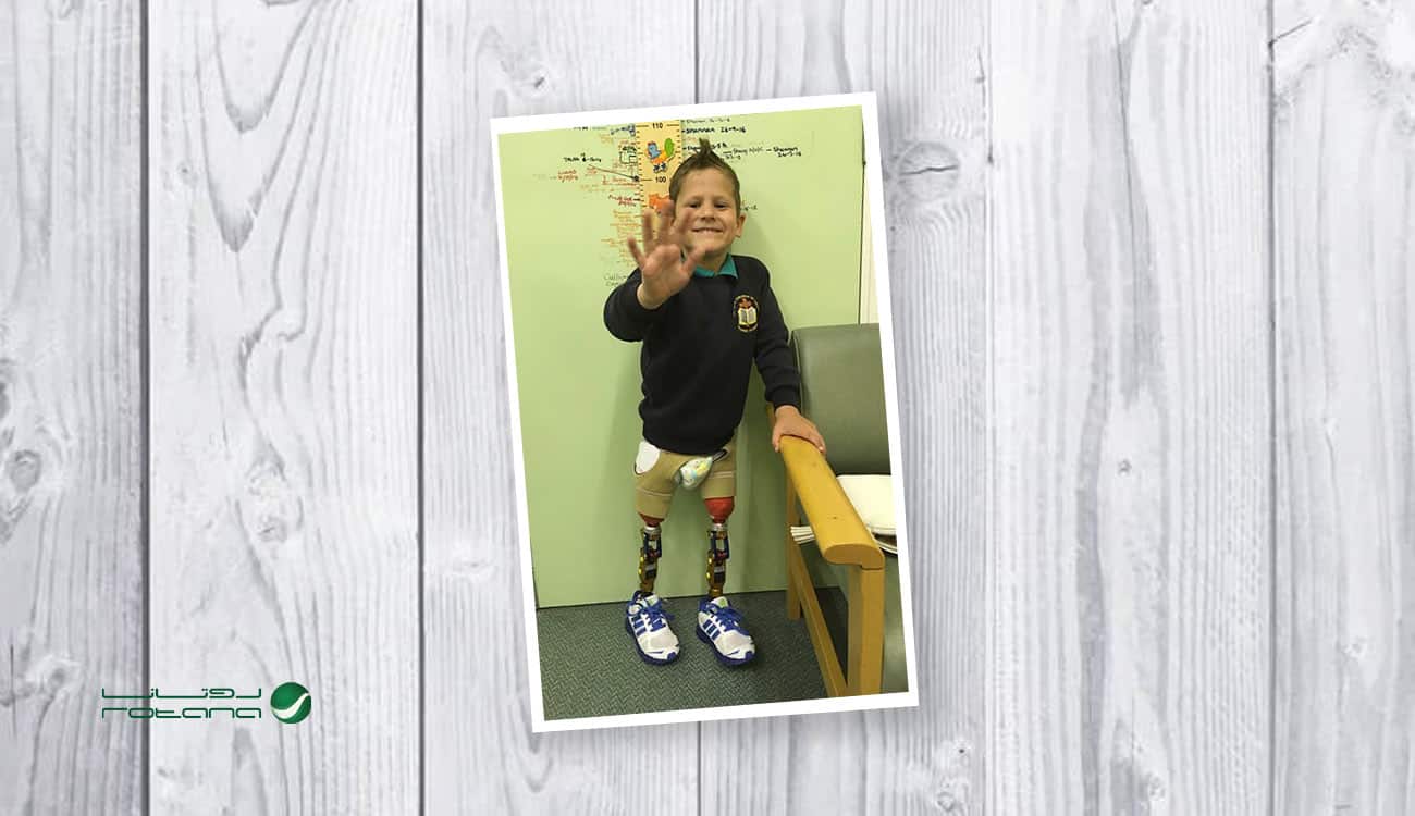 فيديو.. الخطوات الأولى لطفل فقد ساقيه بسبب مرض نادر