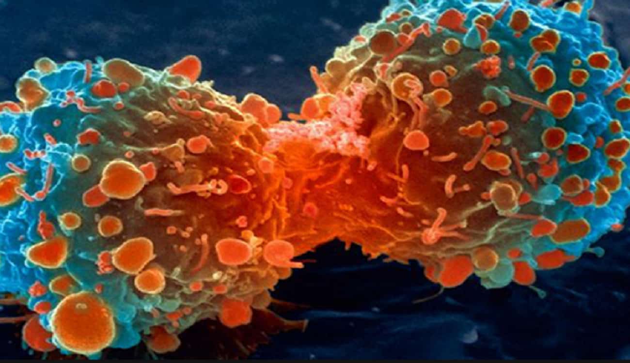 «خلية الزومبي».. اكتشاف يعيد تأريخ مرض السرطان
