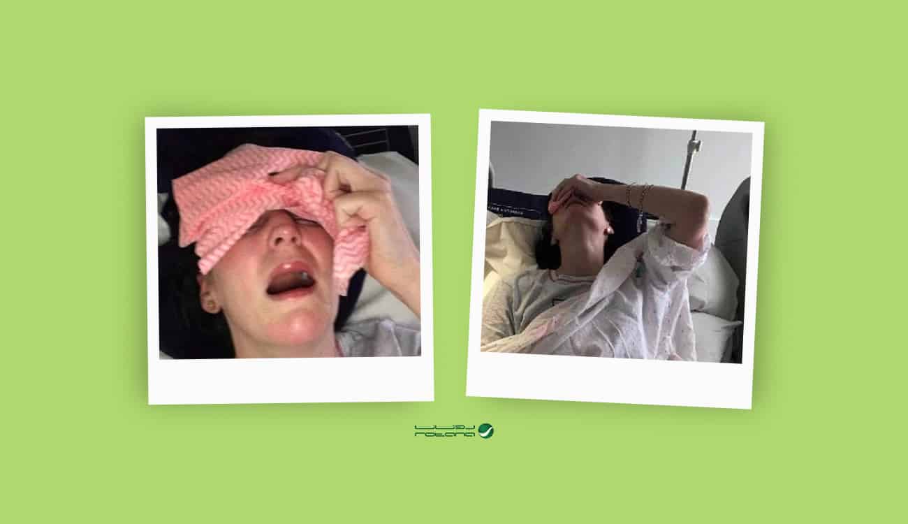 امرأة تصاب بصدمات كهربية مروعة بسبب متلازمة "إلهرز دانلوس"
