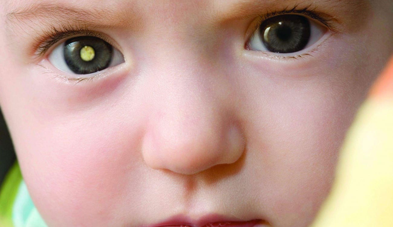 فيديو مؤثر.. طفل يرى للمرة الأولى بعين اصطناعية