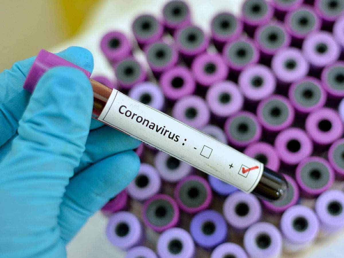 الصحة تعلن تسجيل أربع حالات جديدة بفيروس كورونا